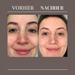 UpCircle Kaffee-Gesichtspeeling Zitrus