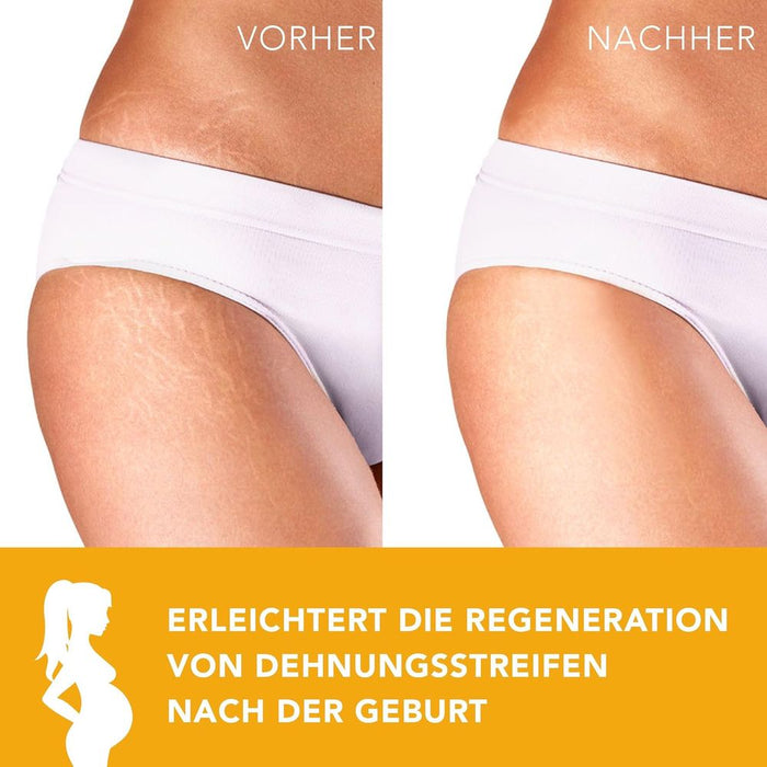 AIESI Süßmandelöl Ph.Eur.