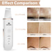 Face Skin Spatula Ultraschallpeelinggerät Skin Scrubber Mitesserentferner Porenreiniger Gesicht Schönheitspflege Gesichtslifting Werkzeug Mitesser